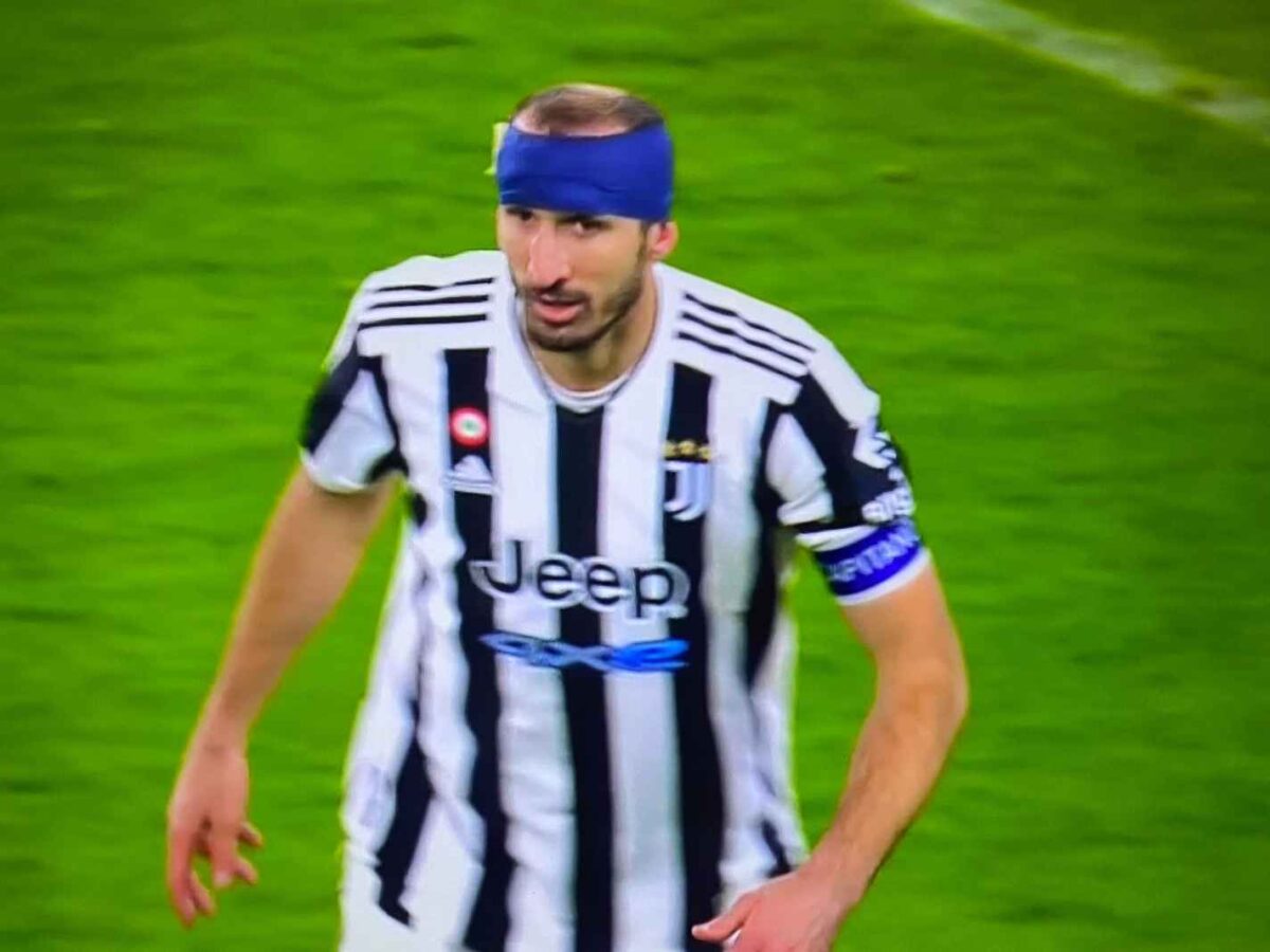 Giorgio Chiellini plays with bandaged head against Roma