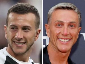 Former Juventus Winger Federico Bernardeschi Looks Unrecognizable Now