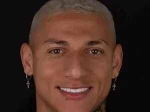 How Much Did Richarlison’s Teeth Makeover Cost